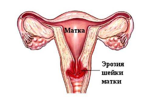 Полезен ли мужской Иван-чай для женского организма