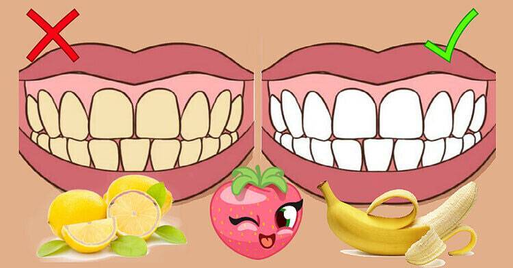 Точки и пятна на зубах | «см-стоматология»