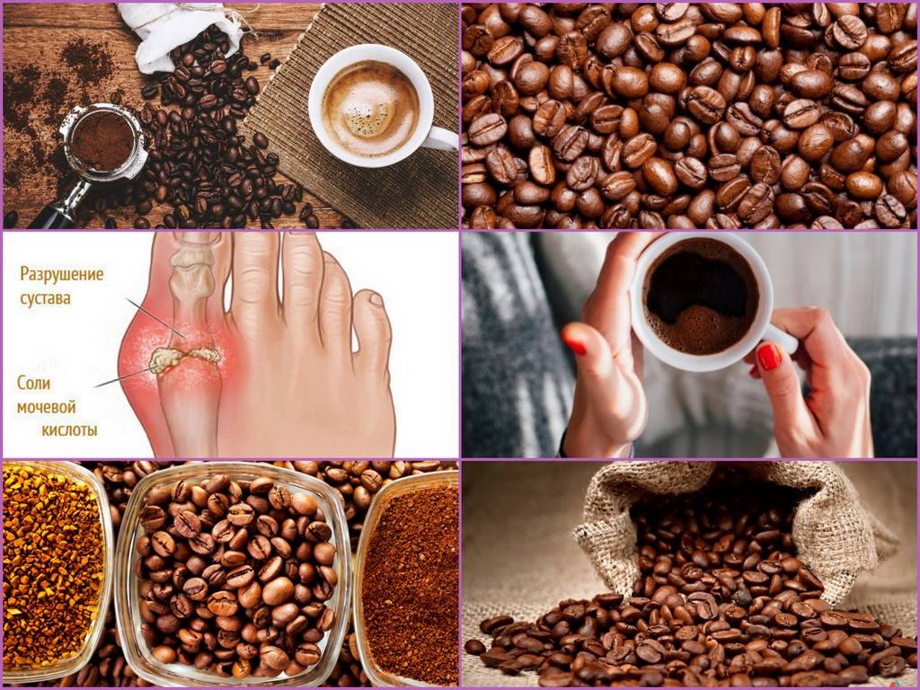 Кофе при гастрите: правила приготовления и употребления, вред и противопоказания