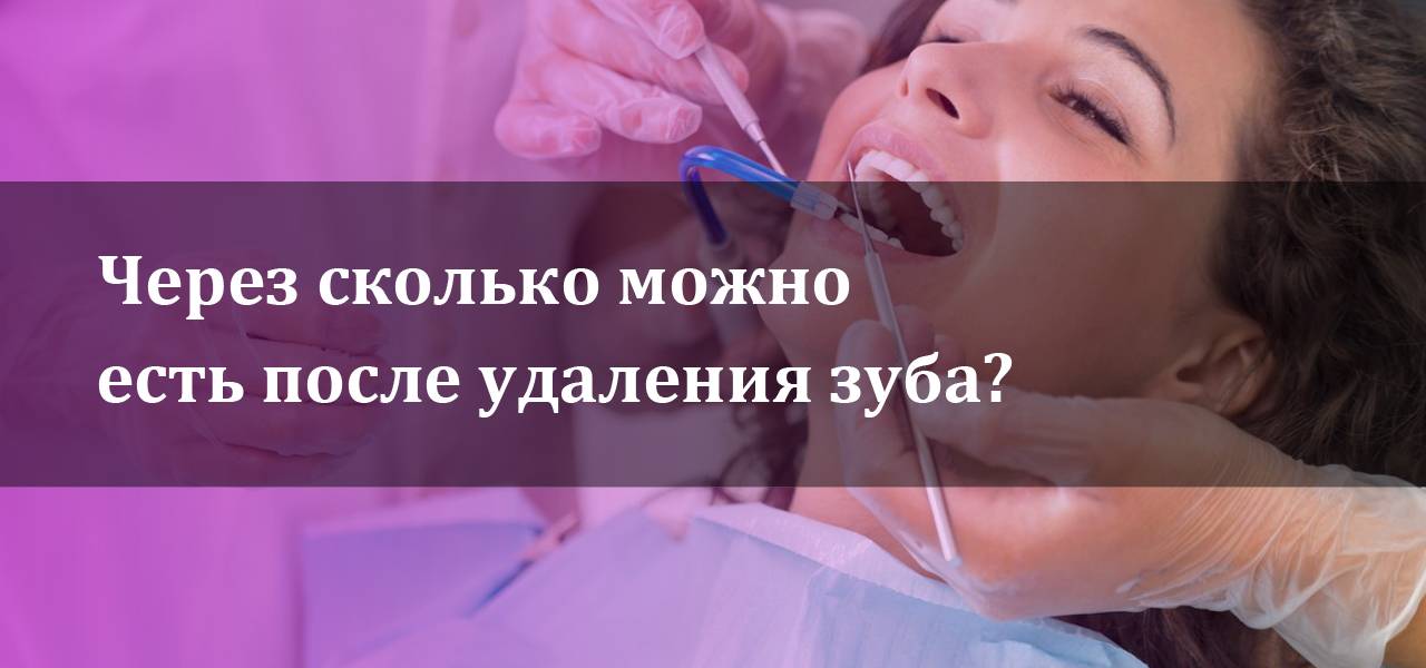 Рекомендации после удаления зуба — стоматология комфорта
