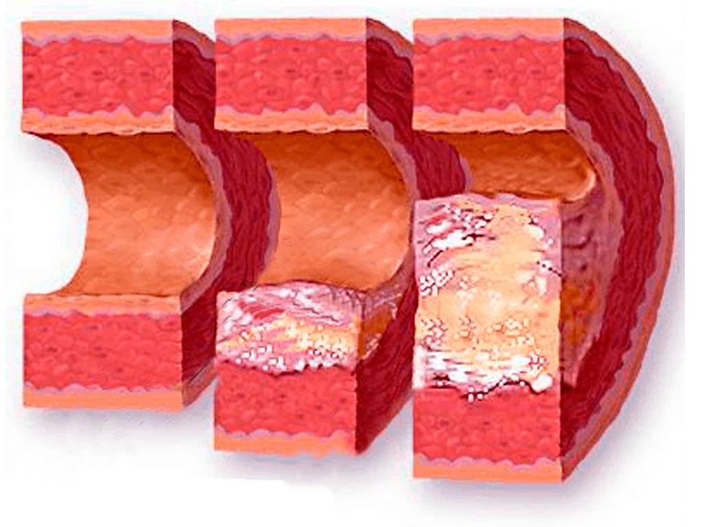 Нейтрализовать кофеин и спастись от похмелья. В чем еще состоит польза и вред кофе с лимоном