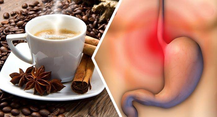 Изжога от кофе: почему напиток вызывает неприятные ощущения, как с этим бороться?