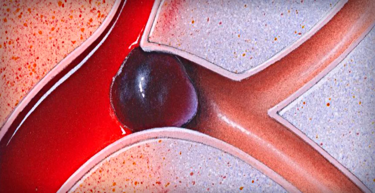 Настойка пустырника