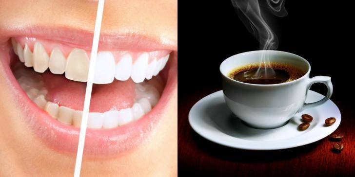 Чёрные зубы: почему они темнеют и как с этим бороться? — клиника доктора федорова
