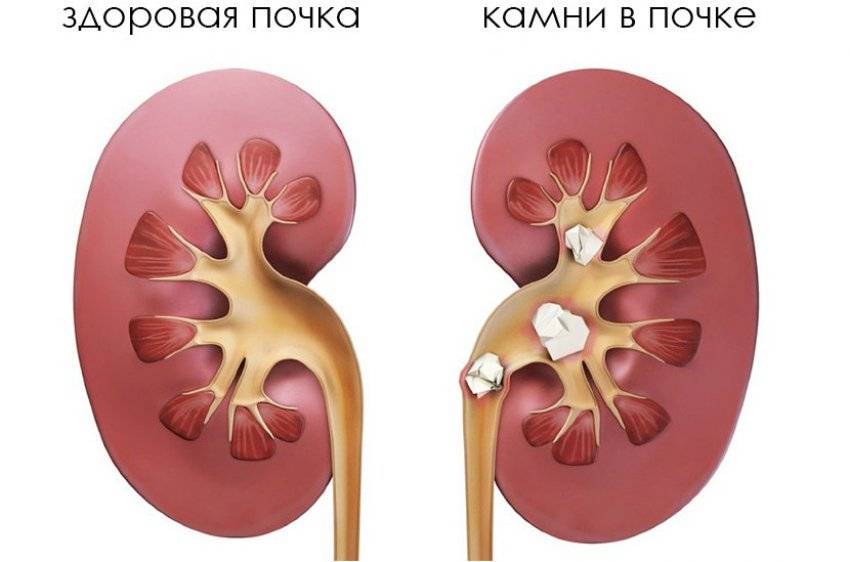 Корень шиповника – полезные свойства и особенности заваривания