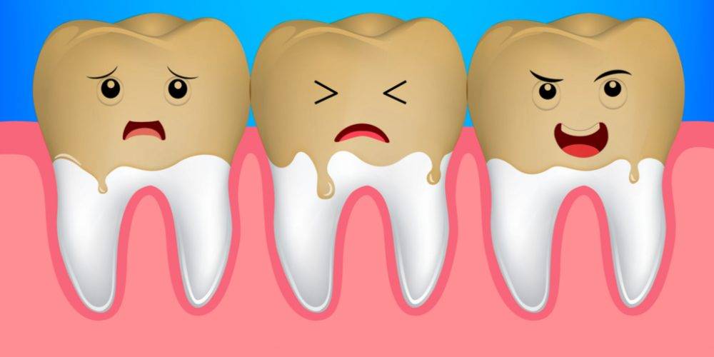 Какие продукты окрашивают зубы?