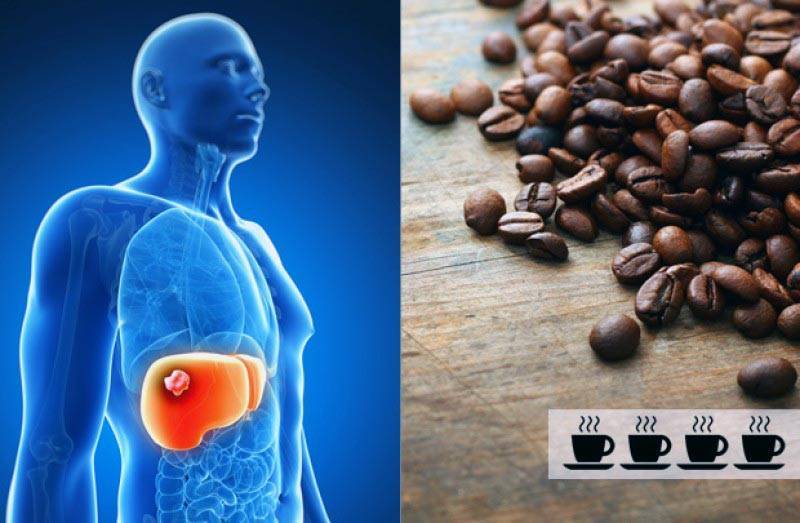 Как кофе влияет на печень и желчный пузырь: вред или польза, можно ли пить кофе после удаления желчного пузыря