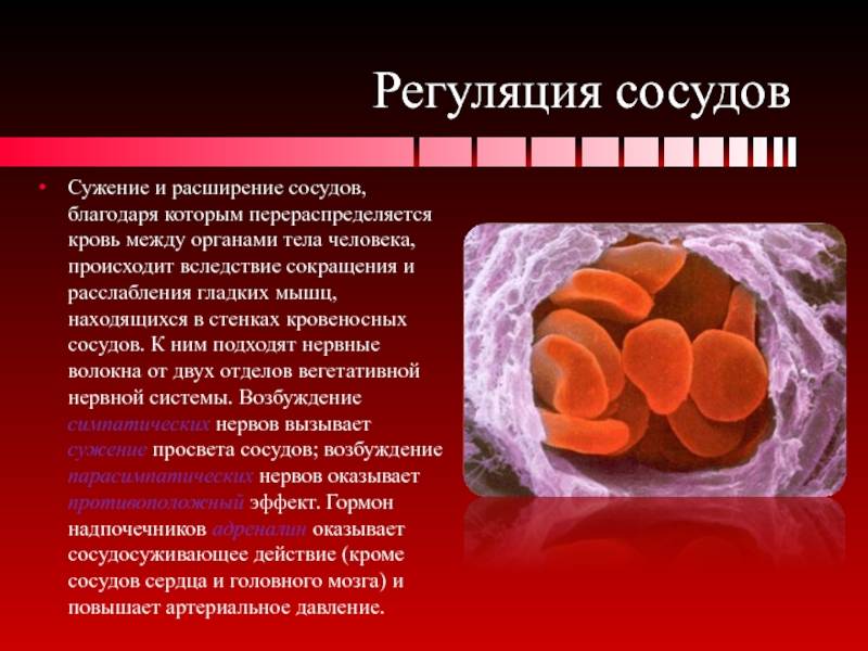 Артериальная аневризма головного мозга - гаврилов антон григорьевич