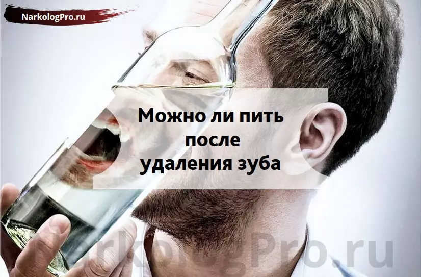 Через сколько пьют после удаления. Что можно пить после удаления зуба. Через сколько можно пить после удаления зуба. Алкоголь после удаления зуба.