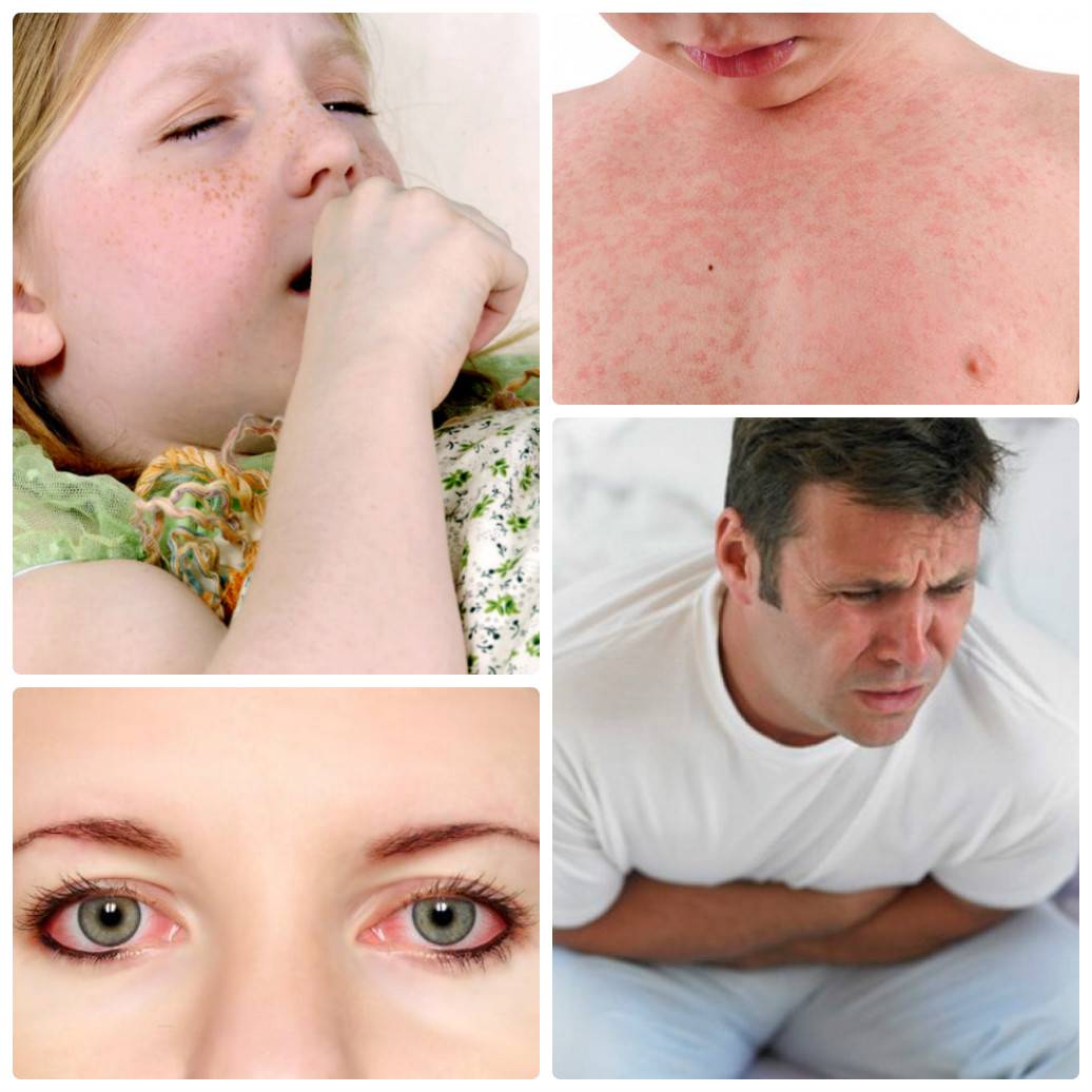 Аллергический кашель. причины, симптомы и лечение аллергического кашля!