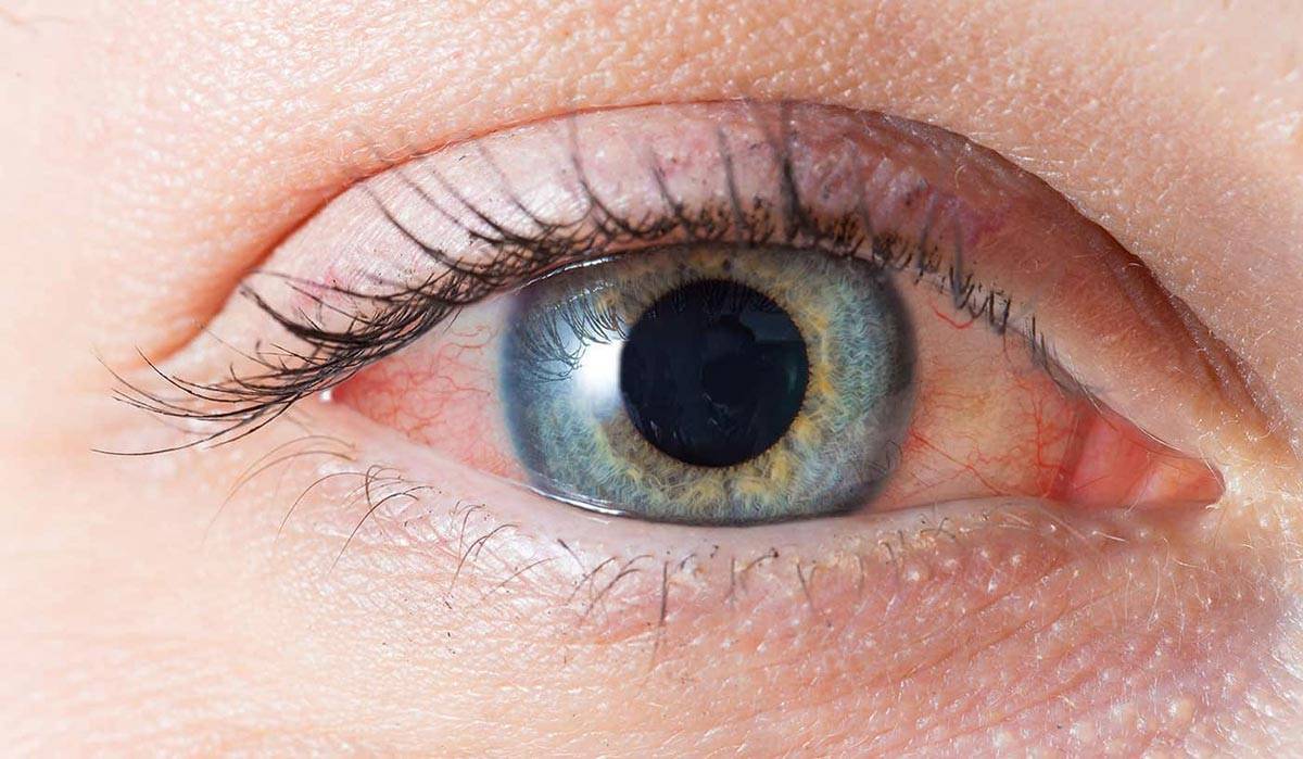 Неожиданные свойства спитого чая, или как применить использованную заварку