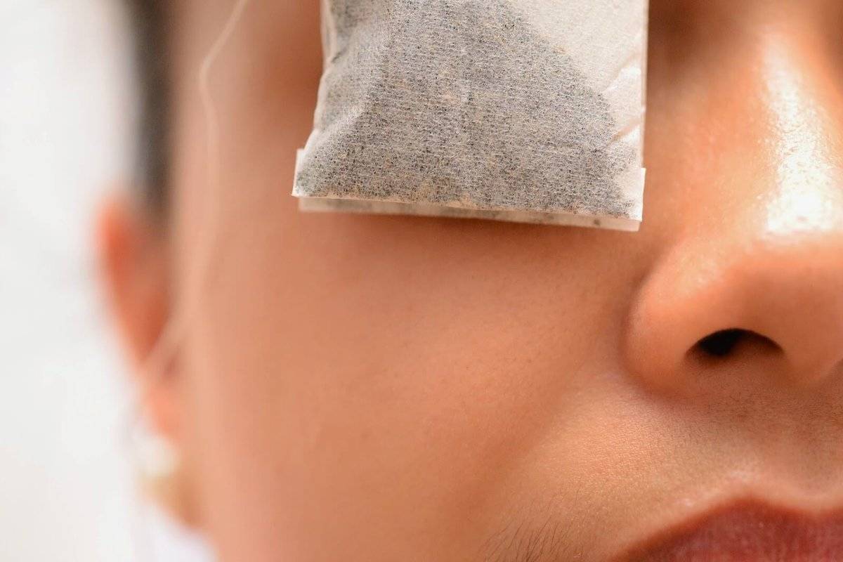 Чайные пакетики на глаза: применение от отеков, мешков, ячменя