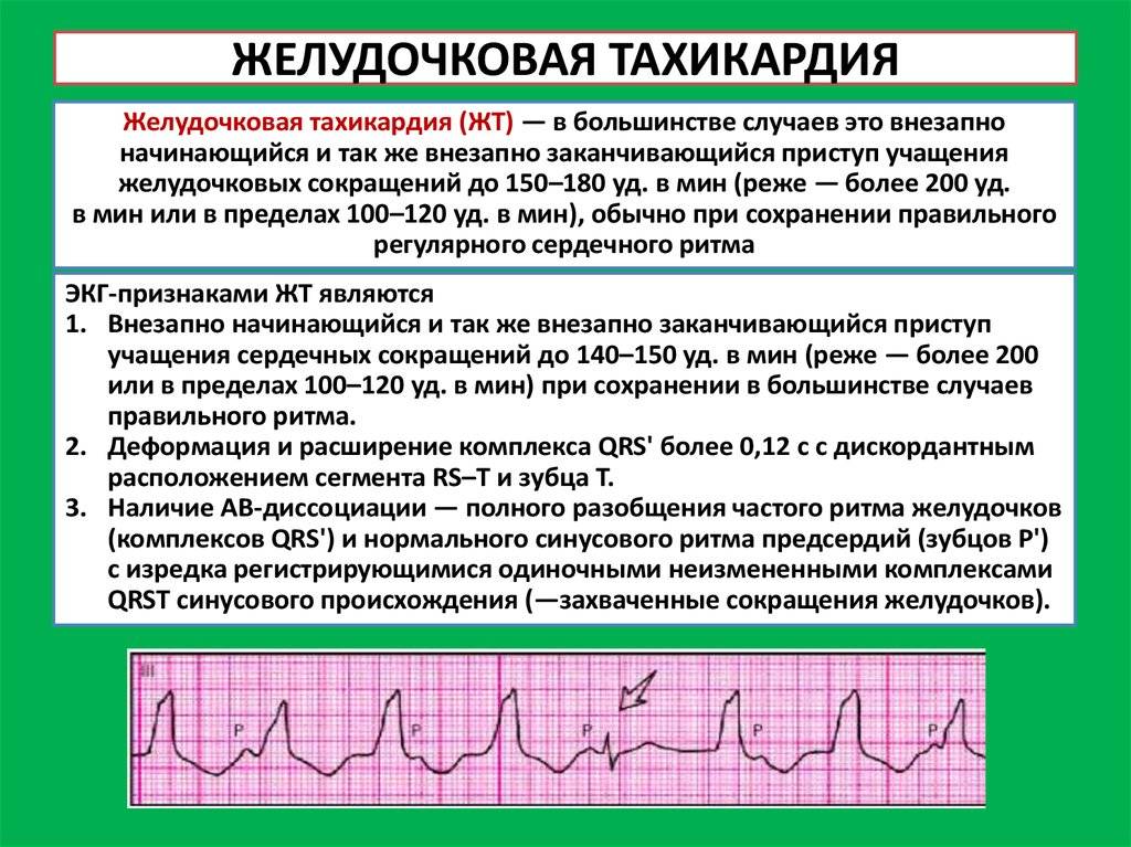 Влияние кофе на сердечный пульс и аритмию
